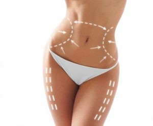 “Top Liposuction Clinics in Boston, MA: Transform Your Body Today”